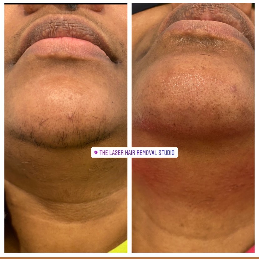 Laser Hair Removal Studio Image